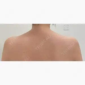 TCB東京中央美容外科 札幌駅前院口コミ