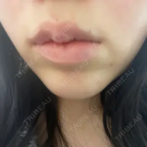 ルラ美容クリニック 渋谷本院口コミ