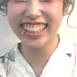 千葉美容外科アイビークリニック口コミ