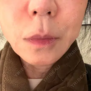 湘南美容皮フ科 京都河原町院口コミ