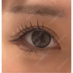 フィラークリニック 大阪心斎橋院口コミ