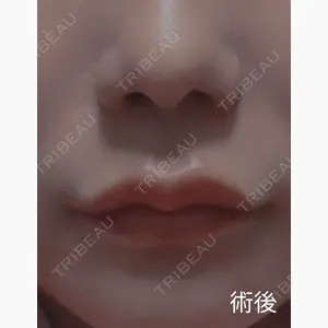 ルラ美容クリニック 大阪本院口コミ