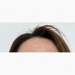 DAILY SKIN CLINIC 福岡院口コミ