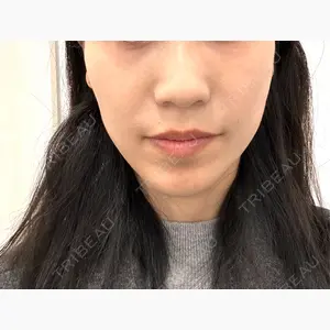 TCB東京中央美容外科 名古屋栄院口コミ