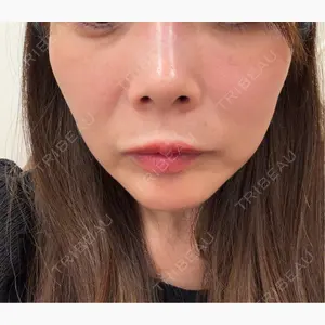 フィラークリニック 大阪心斎橋院口コミ