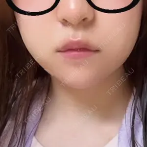 ルラ美容クリニック 大阪本院口コミ