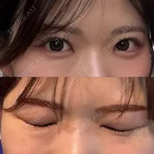 PRO CLINIC プロクリニック 銀座院口コミ