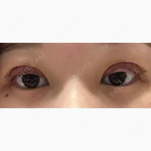 S.T styleクリニック口コミ