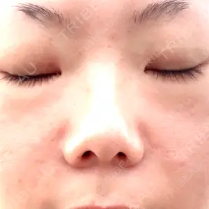 博多美容外科/美容皮膚科 ビラビューティークリニック口コミ