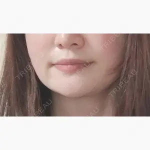 RIVER CLINIC（リバークリニック）口コミ