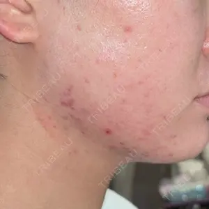 ルラ美容クリニック 神戸院口コミ