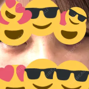 TCB東京中央美容外科 藤沢院口コミ