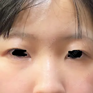 フィラークリニック 大阪心斎橋院口コミ