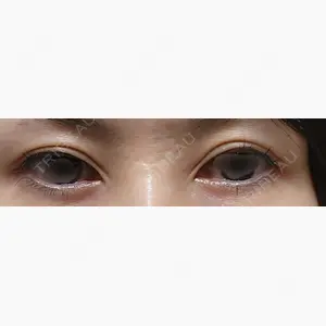 BIANCA銀座口コミ