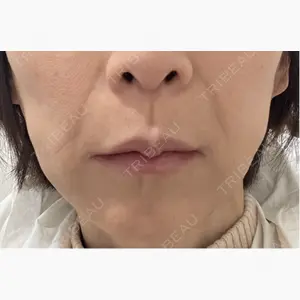 TCB東京中央美容外科 神戸院口コミ