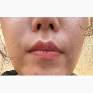 BiBiクリニック口コミ