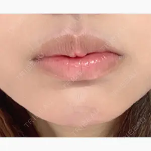 アリエル美容クリニック 横浜院口コミ