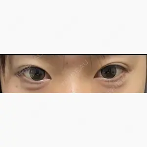 愛知春日井美容外科ネビュラクリニック口コミ