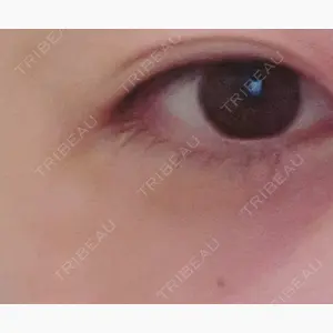 やさしい美容皮膚科・皮フ科　秋葉原院口コミ