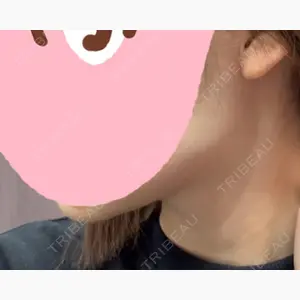 東京美容皮膚科アロエクリニック池袋口コミ