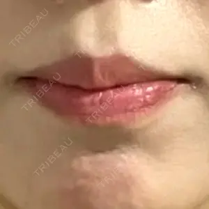 ルラ美容クリニック 福岡天神院口コミ