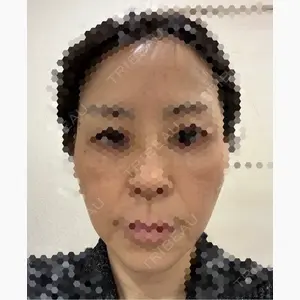 X CLINIC 大阪院口コミ