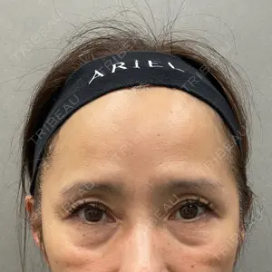 アリエル美容クリニック 大宮院口コミ