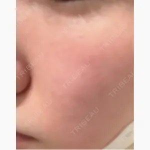 おおたかの森ビューティークリニック口コミ