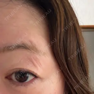 ルラ美容クリニック 大阪本院口コミ