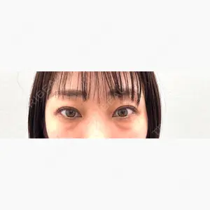 仙台駅前美容外科口コミ