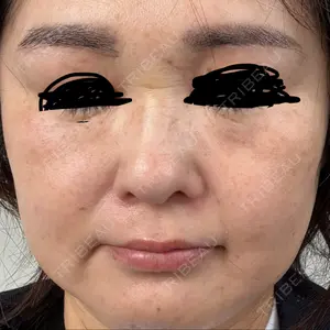 アサイクリニック 心斎橋本院口コミ