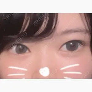 TCB東京中央美容外科 奈良院口コミ