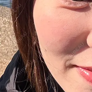 千葉美容外科アイビークリニック口コミ