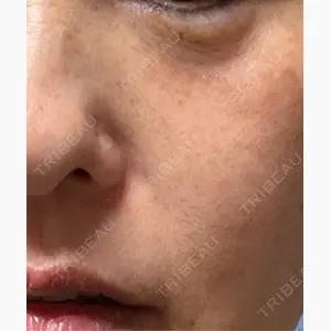 ルラ美容クリニック 横浜院口コミ