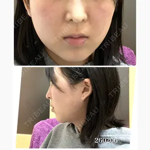 ルラ美容クリニック 新潟院口コミ