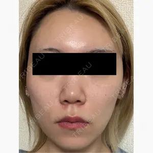 ゆきスキンクリニック 東池袋口コミ