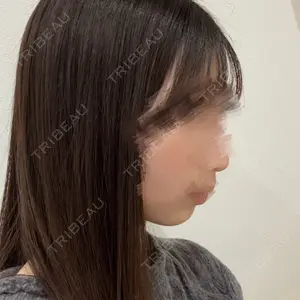 SUNMELIA SKIN CLINIC口コミ