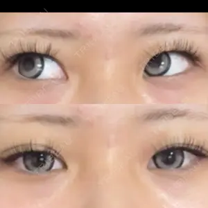 東京シンデレラ美容外科 新宿院口コミ