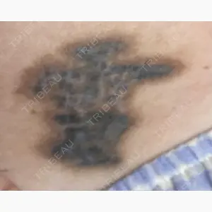 アサイクリニック 心斎橋本院口コミ