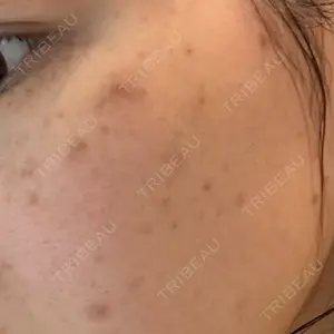 ルラ美容クリニック 福岡本院口コミ