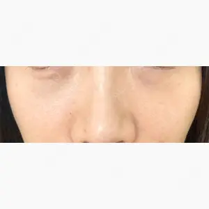 千葉美容外科アイビークリニック口コミ