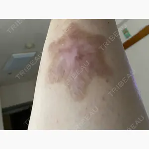 アサイクリニック 心斎橋本院口コミ