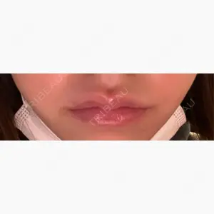 新宿クレアクリニック口コミ