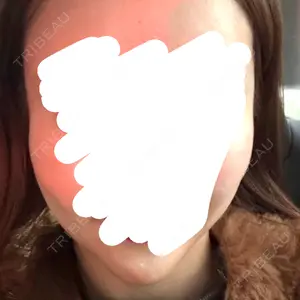 Days Beauty Clinic 新宿院口コミ