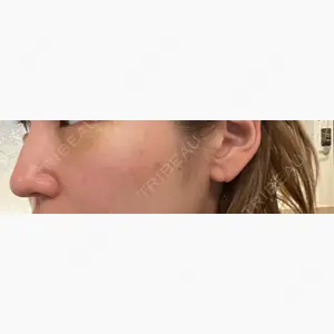 HAAB×DREAM BEAUTY CLINIC 大阪梅田院口コミ