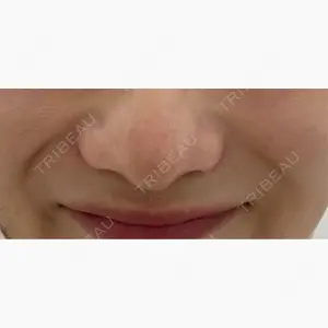 ギャラリークリニック 横浜院口コミ