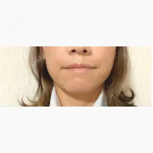 上野注入クリニック口コミ