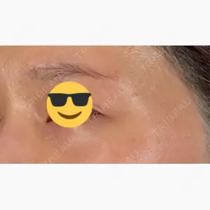 小倉美容外科ネビュラクリニック口コミ