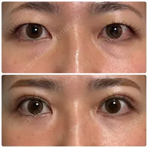 神戸美容外科 ネビュラクリニック口コミ