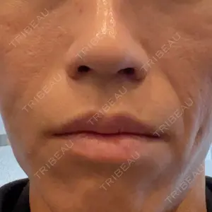 ゆきスキンクリニック 東池袋口コミ